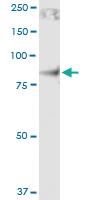 Anti-ITGB7 Rabbit Polyclonal Antibody