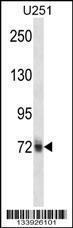 Anti-HNRNPM Rabbit Polyclonal Antibody (APC (Allophycocyanin))