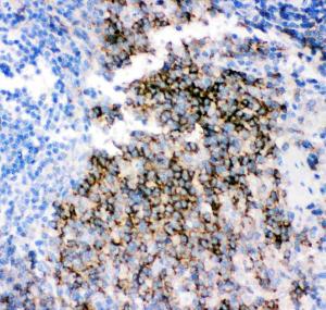 Anti-CD79b Polyclonal Antibody