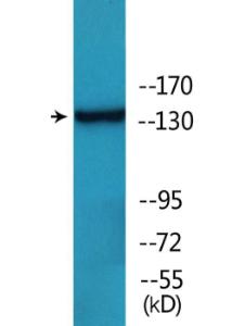 Western blot analysis of lysates from HepG2 cells treated with PMA 125 ng/ml 20' using Anti-HER2 (phospho Tyr1112) Antibody