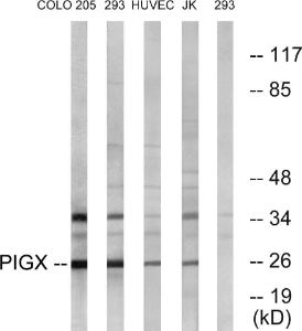 Anti-PIGX Rabbit Polyclonal Antibody