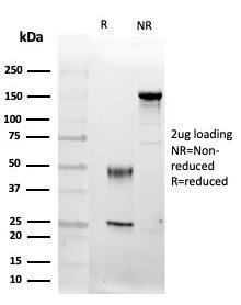 SDS-PAGE analysis of Anti-FGF23 Antibody [FGF23/4174] under non-reduced and reduced conditions; showing intact IgG and intact heavy and light chains, respectively. SDS-PAGE analysis confirms the integrity and purity of the antibody