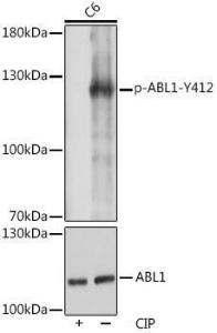 Western blot analysis of extracts of C6 cells, using Anti-ABL1 (phospho Tyr412) Antibody (A305660) at 1:1,000 dilution or ABL1 antibody (A0282). C6 cells were treated by CIP(20uL/400ul) at 37°C for 1 hour. The secondary antibody was Goat Anti-Rabbit IgG HandL Antibody (HRP) at 1:10,000 dilution