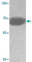 Anti-ADAM20 Rabbit Polyclonal Antibody