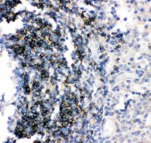 Anti-CD79b Polyclonal Antibody