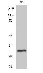 Anti-PIGX Rabbit Polyclonal Antibody