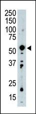 Anti-PDK2 Rabbit Polyclonal Antibody