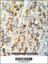 Anti-CECR5 Rabbit Polyclonal Antibody