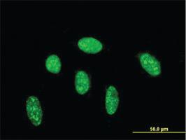 Anti-CDX1 Mouse Monoclonal Antibody [clone: 3C5]