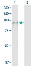 Anti-ITGB7 Rabbit Polyclonal Antibody