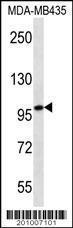 Anti-MYO1C Mouse Monoclonal Antibody [clone: 221CT4.7.2.4]