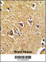 Anti-Proline Dehydrogenase Rabbit Polyclonal Antibody (HRP (Horseradish Peroxidase))