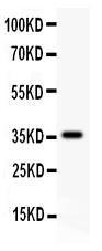 Anti-CD82/Kai 1 Polyclonal Antibody