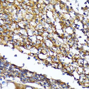 Immunohistochemistry analysis of paraffin-embedded human colon tissue using Anti-CD82 Antibody [ARC1501] (A308137) at a dilution of 1:100 (40X lens). Perform microwave antigen retrieval with 10 mM Tris/EDTA buffer pH 9.0 before commencing with IHC staining protocol