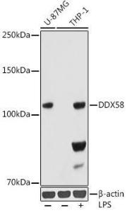 Western blot analysis of extracts of various cell lines, using Anti-RIG-I/DDX58 Antibody [ARC0824] (A309662) at 1:1,000 dilution THP-1 cells were treated by LPS (1  µg/ml) at 37°C for 8 hours