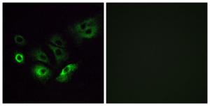 Immunofluorescence analysis of A549 cells using Anti-OR4Q3 Antibody. The right hand panel represents a negative control, where the antibody was pre-incubated with the immunising peptide.