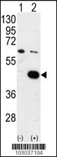 Anti-PDK2 Rabbit Polyclonal Antibody