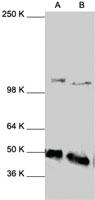 Anti-NFKB1 Rabbit Polyclonal Antibody