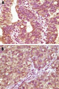 Anti-BRAF Mouse Monoclonal Antibody [clone: 1H12F1,1H12G10,1F12F11C9]