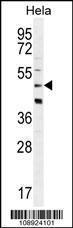 Anti-CRFR2D Rabbit Polyclonal Antibody