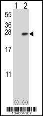 Anti-YWHAB Rabbit Polyclonal Antibody (HRP (Horseradish Peroxidase))