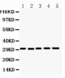 Anti-CD82/Kai 1 Polyclonal Antibody