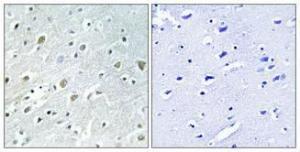 Anti-PIGX Rabbit Polyclonal Antibody