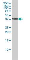 Anti-BAG1 Mouse Monoclonal Antibody [clone: 2D3]