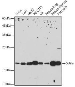 Western blot analysis of extracts of various cell lines, using Anti-Cofilin Antibody [ARC2615] (A307020) at 1:1,000 dilution The secondary antibody was Goat Anti-Rabbit IgG H&L Antibody (HRP) at 1:10,000 dilution Lysates/proteins were present at 25 µg per lane