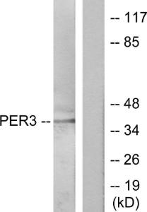 Anti-PER3 antibody