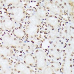 Immunohistochemistry analysis of paraffin-embedded rat kidney using Anti-ABL1 (phospho Tyr412) Antibody (A305660) at a dilution of 1:100 (40X lens)