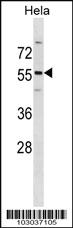 Anti-PDK2 Rabbit Polyclonal Antibody