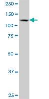 Anti-ZNF280D Mouse Polyclonal Antibody