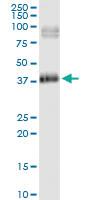 Anti-HSD17B2 Polyclonal Antibody Pair