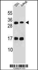 Anti-LOC339742 Rabbit Polyclonal Antibody (AP (Alkaline Phosphatase))