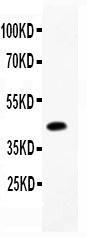 Anti-CEBP Beta Polyclonal Antibody