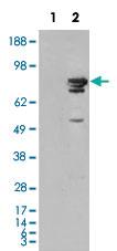 Anti-BRAF Mouse Monoclonal Antibody [clone: 1H12F1,1H12G10,1F12F11C9]