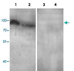 Anti-ADCY3 Rabbit Polyclonal Antibody