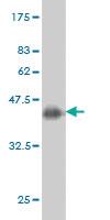 Anti-RNF139 Mouse Monoclonal Antibody [clone: 3D10]