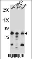 Anti-AFG3L2 Rabbit Polyclonal Antibody (AP (Alkaline Phosphatase))