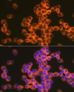 Immunofluorescence analysis of Jurkat cells using Anti-CD82 Antibody [ARC1501] (A308137) at a dilution of 1:100 (40X lens). DAPI was used to stain the cell nuclei (blue)