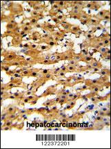 Anti-ADH5 Rabbit Polyclonal Antibody