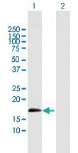 Anti-ZNF280D Mouse Polyclonal Antibody