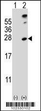 Anti-SENP8 Rabbit Polyclonal Antibody (AP (Alkaline Phosphatase))