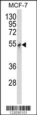 Anti-PDK3 Rabbit Polyclonal Antibody