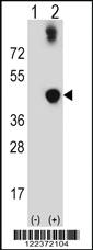 Anti-ADH5 Rabbit Polyclonal Antibody