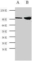 Anti-RB1 Rabbit Polyclonal Antibody