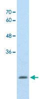 Anti-ALDH4A1 Rabbit Polyclonal Antibody