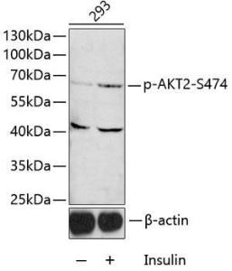 Western blot analysis of extracts of 293 cells, using Anti-AKT2 (phospho Ser474) Antibody (A12450) 1:1,000 dilution.. The secondary antibody was Goat Anti-Rabbit IgG HandL Antibody (HRP) at 1:10,000 dilution. Lysates/proteins were present at 25 µg per lane. The blocking buffer used was 3% BSA