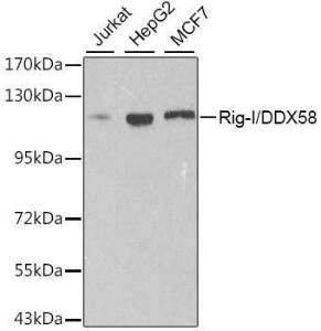 Western blot analysis of extracts of various cell lines, using Anti-RIG-I / DDX58 Antibody (A309664) at 1:500 dilution